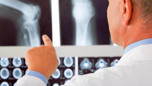 Protesi ortopediche, nel 2020 in rallentamento per il Covid