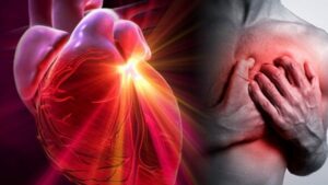 Costo delle malattie cardiovascolari in Europa